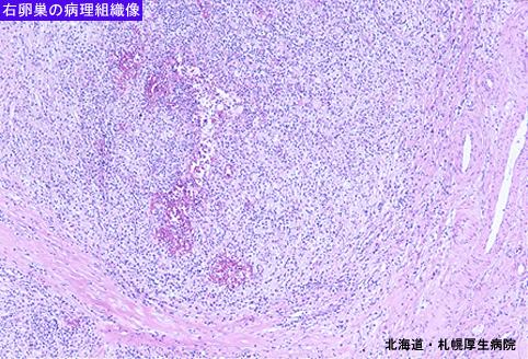 画像ID:5022