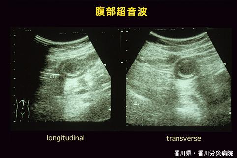 画像ID:5045