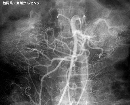 画像ID:5113