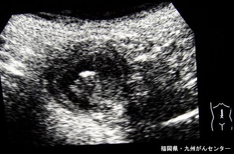 画像ID:5116