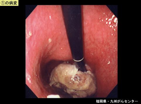 画像ID:5139