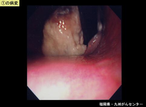 画像ID:5141