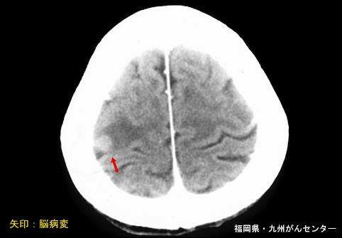 画像ID:5148