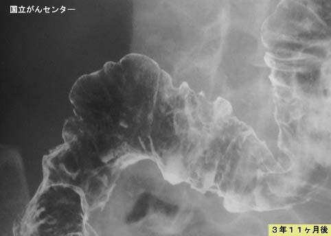 画像ID:5170