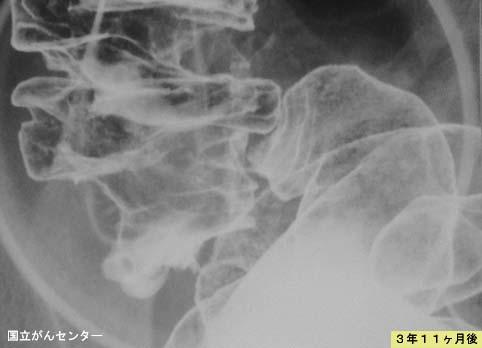 画像ID:5173