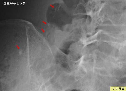 画像ID:5175