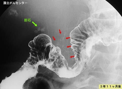 画像ID:5176