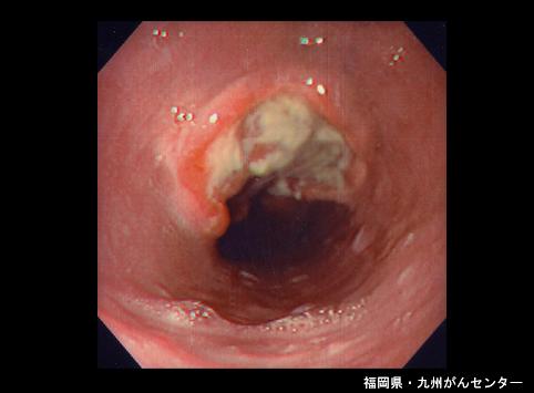 画像ID:5185