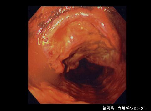 画像ID:5190