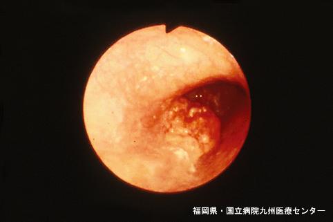 画像ID:5208