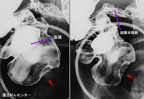 画像ID:5225