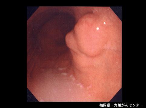 画像ID:5241