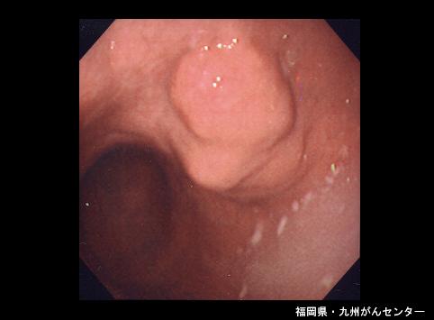 画像ID:5242