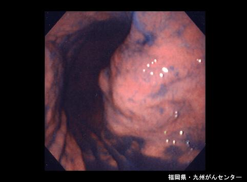 画像ID:5244