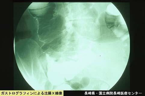 画像ID:5260