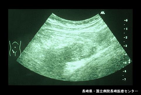 画像ID:5262