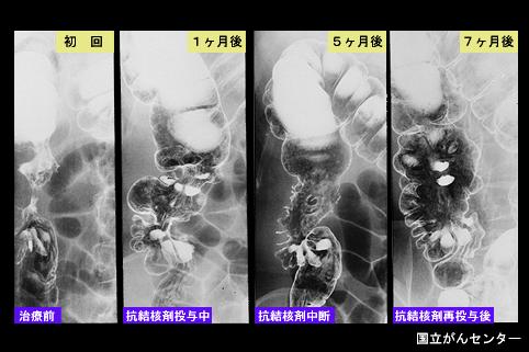 画像ID:5310