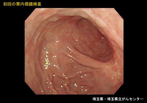 画像ID:5327