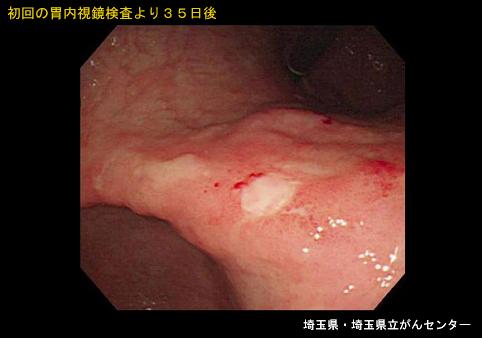画像ID:5335