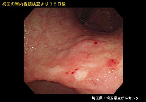 画像ID:5336