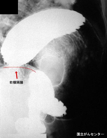 画像ID:5374