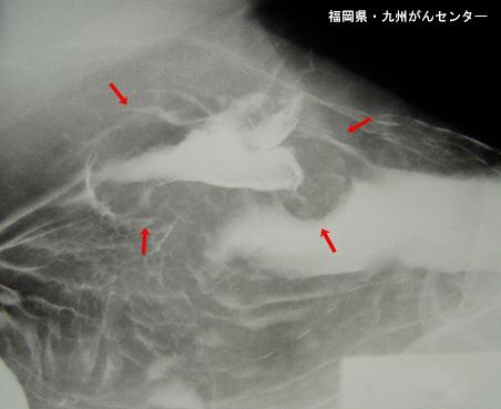 画像ID:5409
