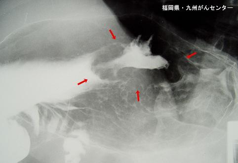 画像ID:5410