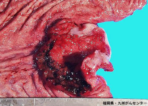 画像ID:5418