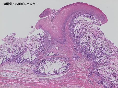画像ID:5423