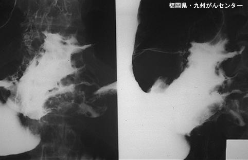 画像ID:5438