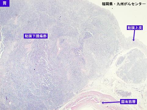 画像ID:5441