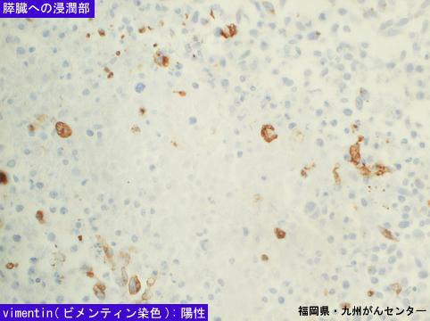 画像ID:5451