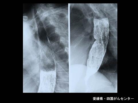 画像ID:5470