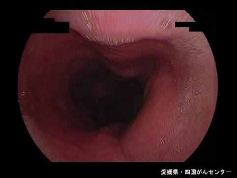 画像ID:5473