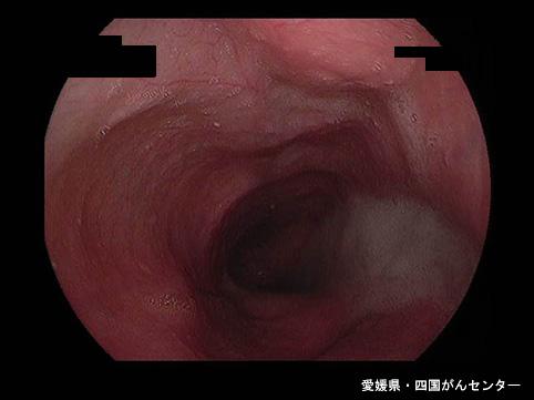 画像ID:5474