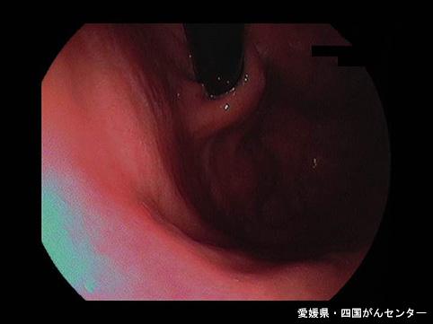 画像ID:5476