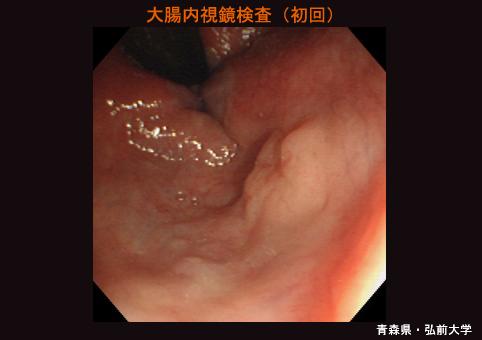 画像ID:5546