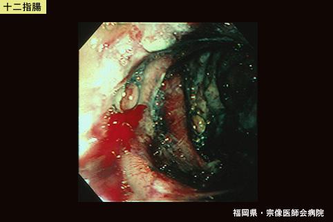 画像ID:5575
