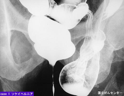 画像ID:5605