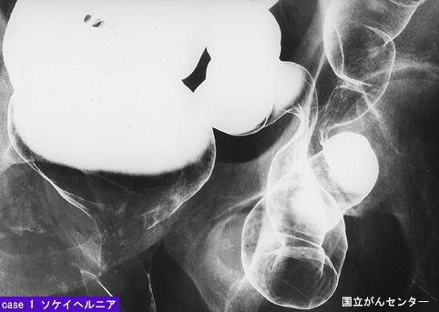 画像ID:5606