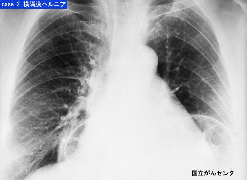 画像ID:5607