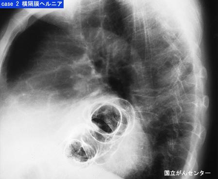 画像ID:5608