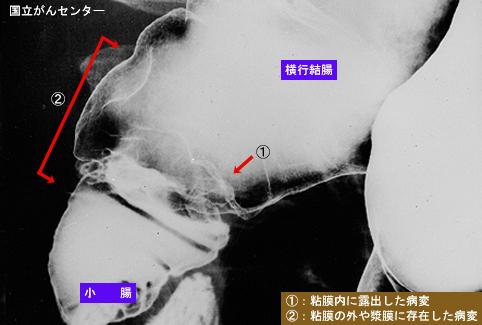 画像ID:5636