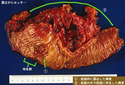 画像ID:5642