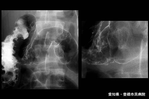 画像ID:5688