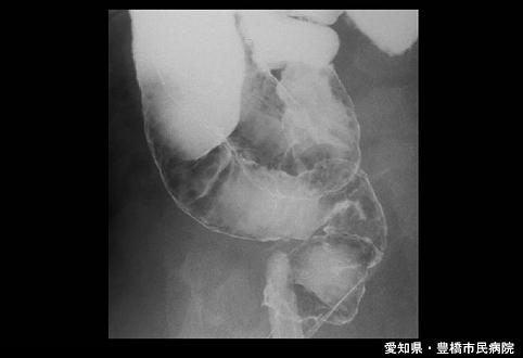画像ID:5713