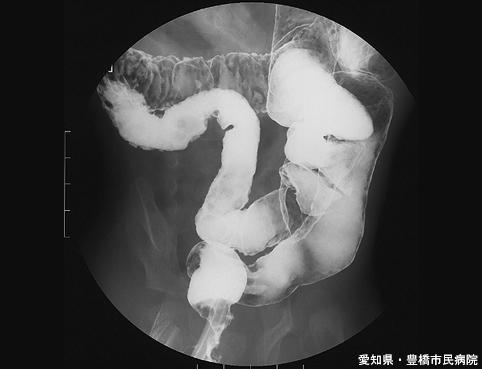 画像ID:5714