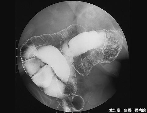 画像ID:5715