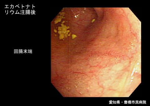画像ID:5724