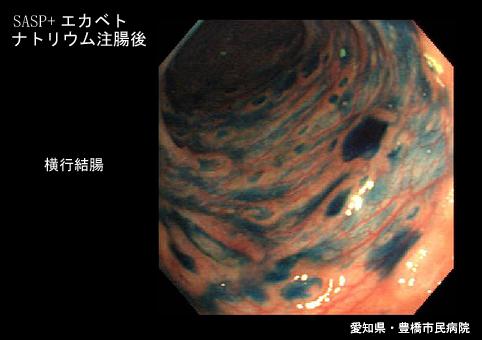 画像ID:5731